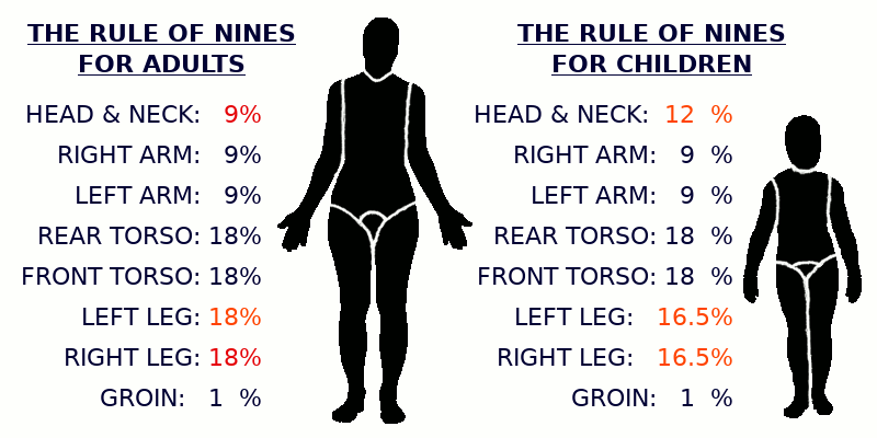 The Rule of Nines Image for Adults and Children